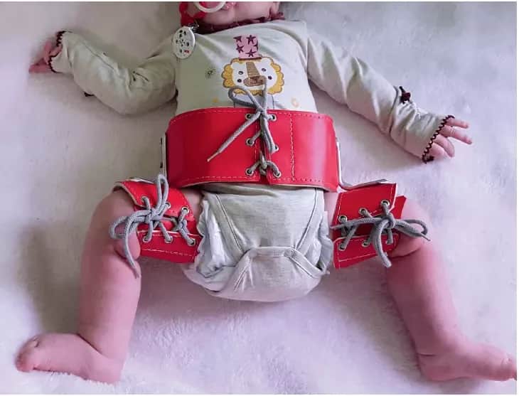 Problemy z bioderkami u niemowlaka: 7 kluczowych objawów